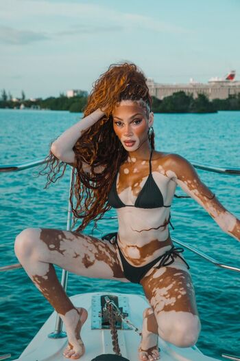 Winnie Harlow